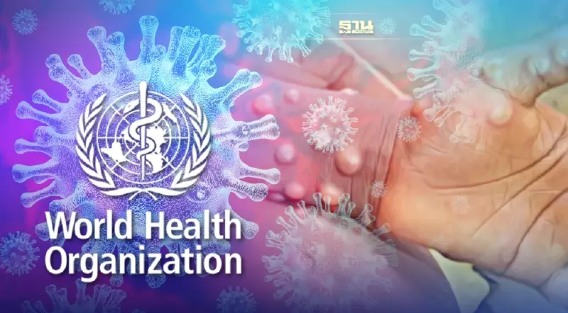 WHO เตรียมเปลี่ยนชื่อ "โรคฝีดาษลิง" เป็น MPOX