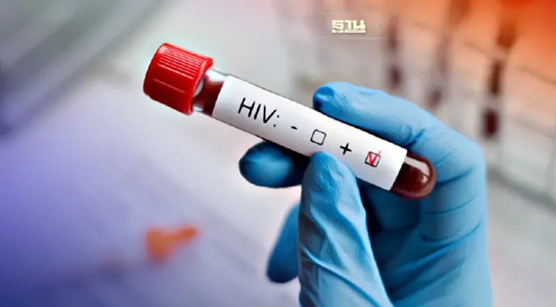 1 ธันวาคม "วันเอดส์โลก" คนไทยได้สิทธิตรวจ HIV ฟรีปีละ 2 ครั้ง 1 ธันวาคม "วันเอดส์โลก" คนไทยได้สิทธิตรวจ HIV ฟรีปีละ 2 ครั้ง