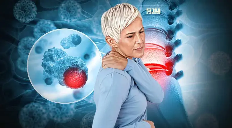 ปวดหลังเรื้อรัง สัญญาณเตือน"เนื้องอกไขสันหลัง"เสี่ยงถึงอัมพาตได้ ปวดหลังเรื้อรัง สัญญาณเตือน"เนื้องอกไขสันหลัง"เสี่ยงถึงอัมพาตได้