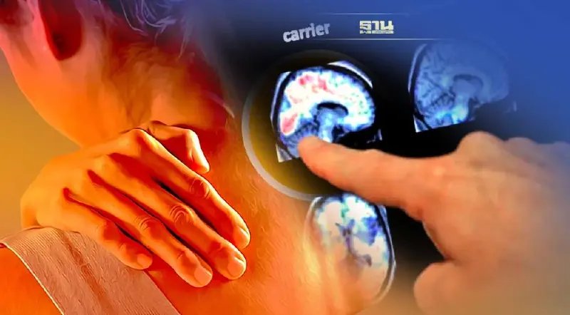 ทำความรู้จัก "โรคคนแข็ง" เมื่อภูมิคุ้มกันทำงานผิดพลาด