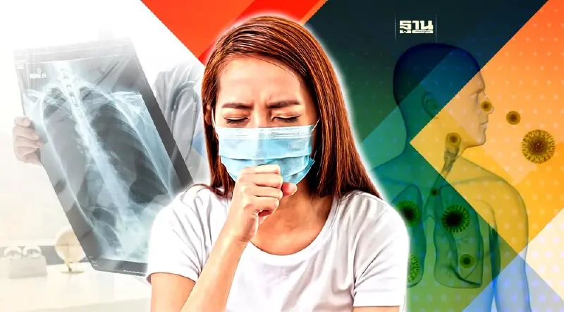 วิธีป้องกัน-แพร่เชื้อวัณโรค หลังพบเสียชีวิตปีละ 1 หมื่นราย