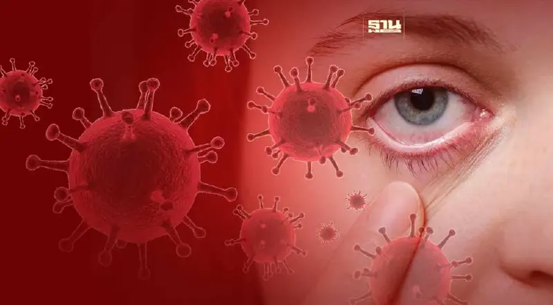 ตาแดงเป็นอาการของโควิดสายพันธุ์ XBB.1.16 หรือไม่ เช็คที่นี่