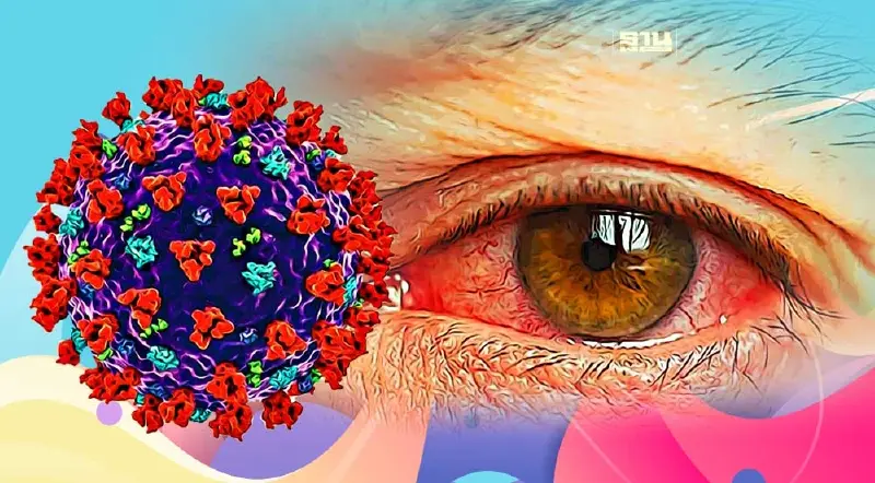 เช็ค 7 อาการตาแดงจากการติดเชื้อโควิด-19