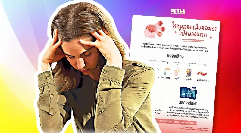 เตือนโรคหลอดเลือดสมองโป่งพองแตก อันตรายพิการถึงตาย