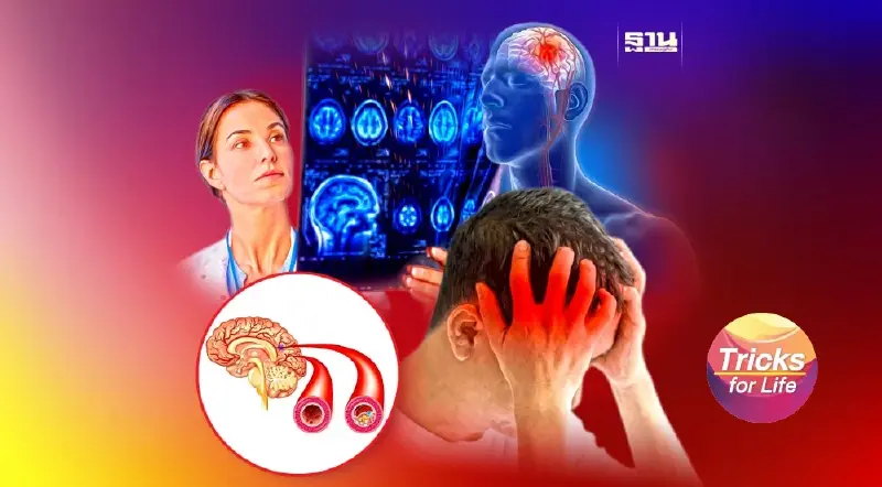 7 ปัจจัยเสี่ยง รู้ไว้ ห่างไกล ‘สโตรก’