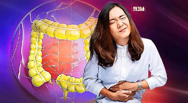 รู้จัก"มะเร็งลำไส้ใหญ่" อาการอย่างไร หลังคร่าชีวิต"ผู้ว่าณรงค์ศักดิ์"