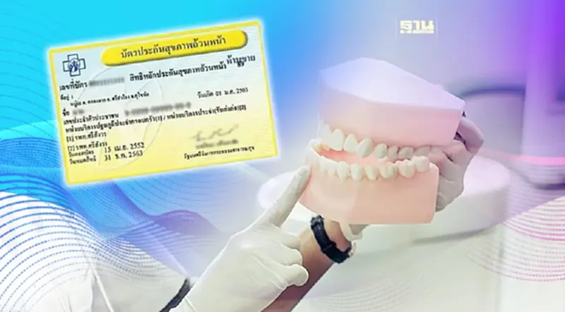 สิทธิบัตรทอง ทําฟันฟรี 13 รายการ มีอะไรบ้าง คลิกที่นี่ สิทธิบัตรทอง ทําฟันฟรี 13 รายการ มีอะไรบ้าง คลิกที่นี่
