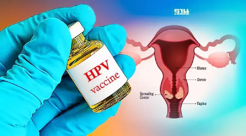 รวมจุดฉีดวัคซีนป้องกันมะเร็งปากมดลูก ชนิด 4 สายพันธุ์ฟรี คลิกที่นี่