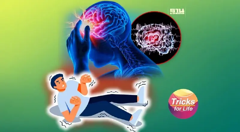 ‘โรคลมชัก’ ภัยเงียบ รักษาได้ โอกาสหายสูง