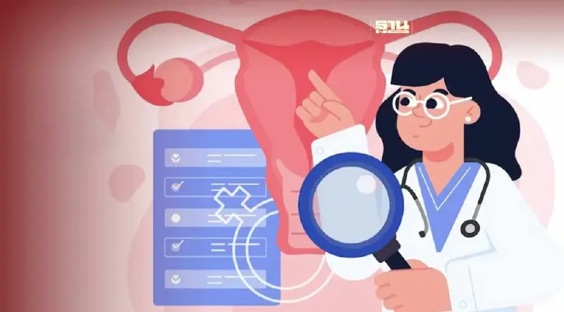 มะเร็งรังไข่เกิดจากอะไร อาการยังไง อันตรายแค่ไหน เช็คเลยที่นี่