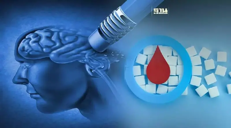 ยาเบาหวานช่วยป้องกันสมองเสื่อมได้ เป็นชนิดไหน เช็คเลยที่นี่