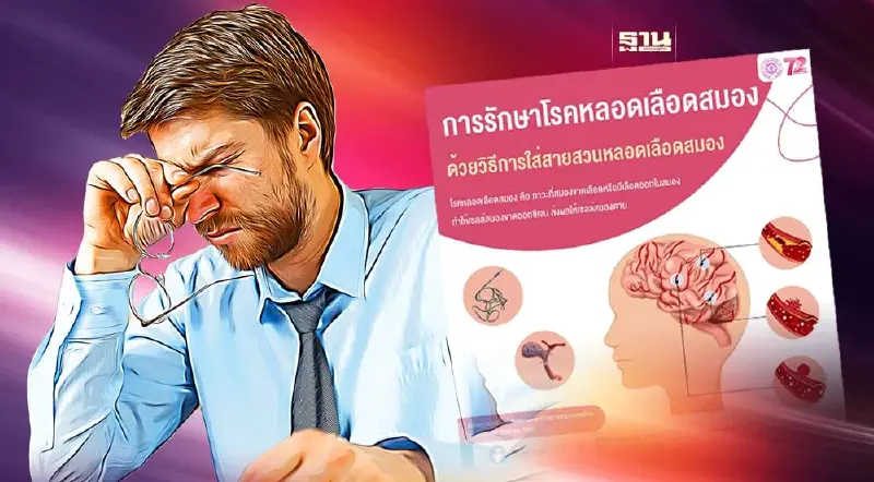 “โรคหลอดเลือดสมอง” กับวิธีรักษาแบบใส่สายสวน  รพ.ราชวิถี