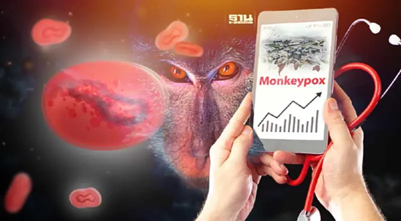 ผวา!ฝีดาษลิง กทม.พุ่ง กรมควบคุมโรคระบุเข้าขั้นอันตรายพื้นที่สีแดง ผวา!ฝีดาษลิง กทม.พุ่ง กรมควบคุมโรคระบุเข้าขั้นอันตรายพื้นที่สีแดง