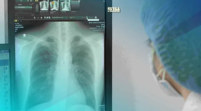 ฟูจิฟิล์ม ชูนวัตกรรมการแพทย์ เดินหน้ายุติวัณโรค