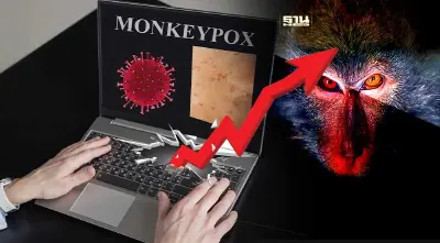 ผวา!ฝีดาษลิงล่าสุดในไทยพุ่ง 385 ราย เสียชีวิตเพิ่ม 1 ราย