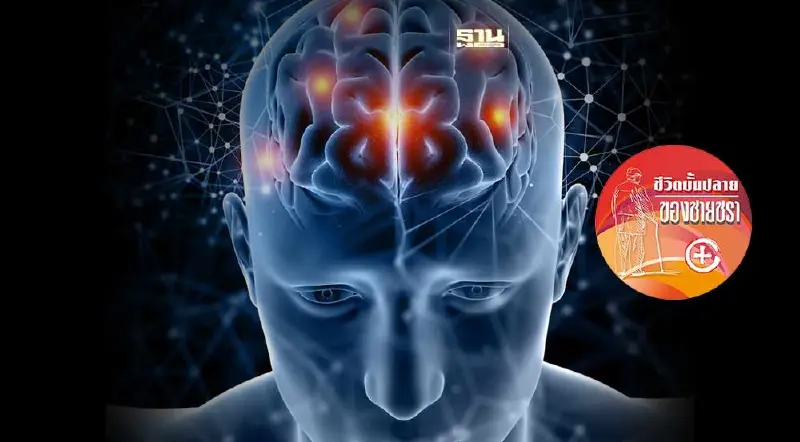 การสั่งการของสมองไม่ปกติ