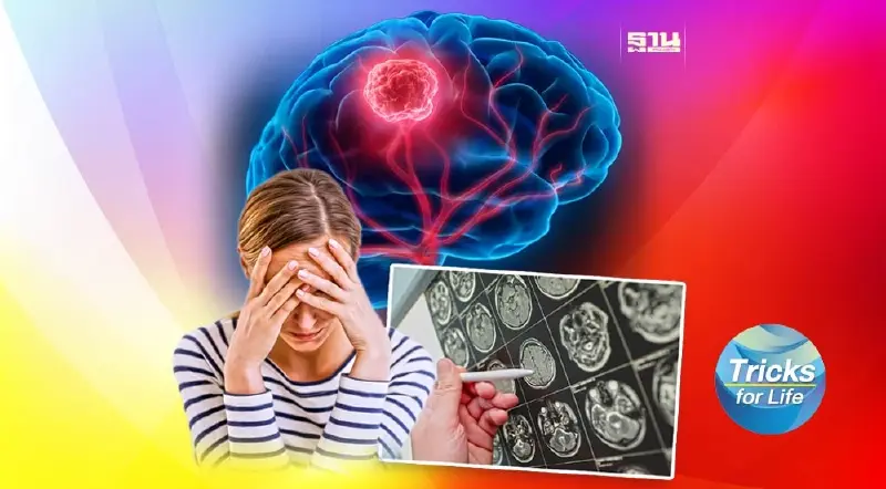 “เนื้องอกในสมอง” รู้เร็ว รักษาได้