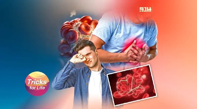 5 สัญญาณเสี่ยง “หลอดเลือดอุดตัน”