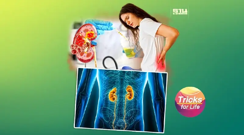 ท่อไตอุดตัน ต้นเหตุ “ภาวะไตวาย”