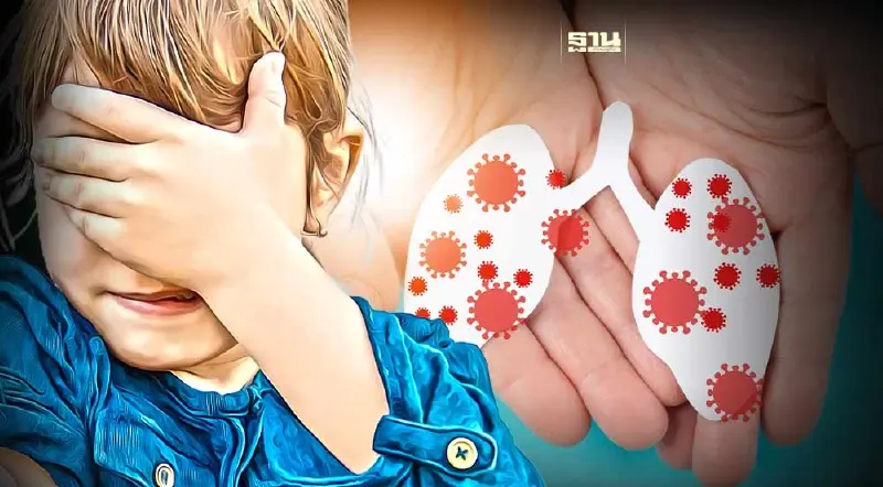 เตือน!RSV เป็นแล้วเป็นซ้ำได้อีก เด็กบางคนเป็นทุกปี