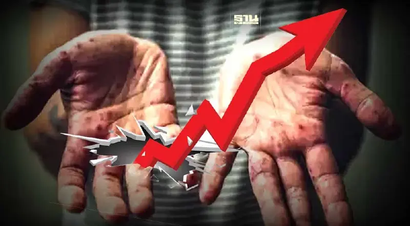 ผวา!ฝีดาษลิงแพร่กระจายสู่เยาวชน พบป่วยเพิ่มมากขึ้นถึง 16 ราย