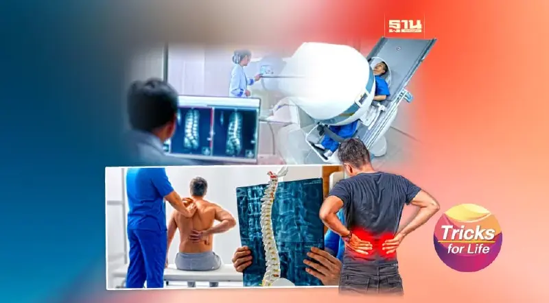 “ปวดหลัง” ทำไมต้อง X-RAY และ MRI