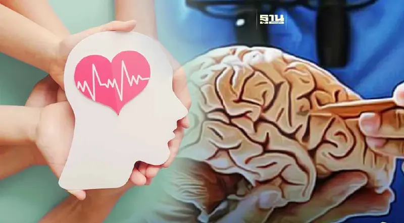 "โรคหลอดเลือดสมอง" 3 วินาที มีผู้ป่วยใหม่ 1 คน ป้องกันได้ด้วย B.E.F.A.S.T