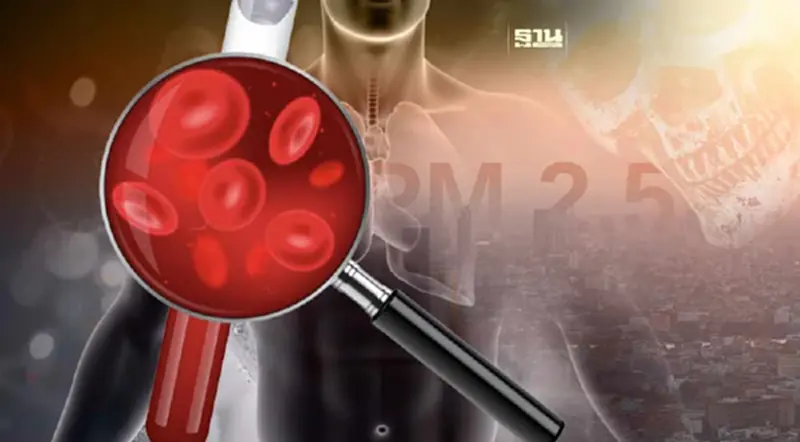 เตือน!สูด "PM.2.5" เสี่ยงหลอดเลือด-อวัยวะอักเสบ เตือน!สูด "PM.2.5" เสี่ยงหลอดเลือด-อวัยวะอักเสบ
