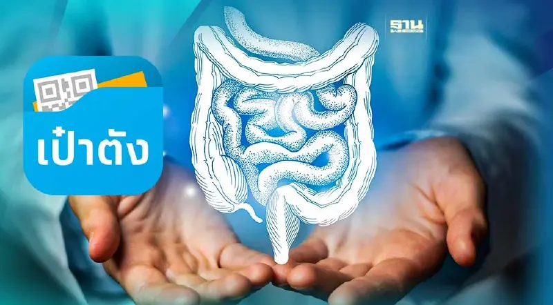 ชวนตรวจมะเร็งลำไส้ใหญ่ฟรี จองคิวผ่านแอปฯ เป๋าตัง