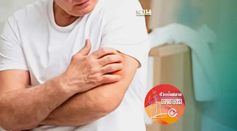 โรคผิวหนังที่มากับความหนาว