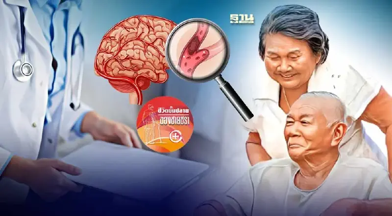 โรคหลอดเลือดในสมอง