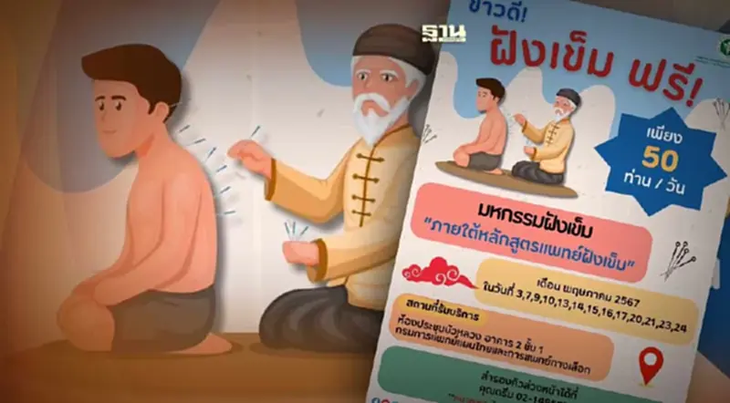 รพ.การแพทย์แผนไทยฯ เปิดลงทะเบียนจองคิวฝังเข็มฟรี! จำนวนจำกัด รพ.การแพทย์แผนไทยฯ เปิดลงทะเบียนจองคิวฝังเข็มฟรี! จำนวนจำกัด