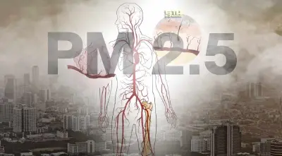 มหิดลชี้ สูด PM2.5 เสี่ยงกระดูกพรุน จากภาวะอักเสบทั่วร่างกาย