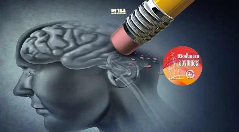 โรคสมองที่ผู้สูงวัยพึงระวัง