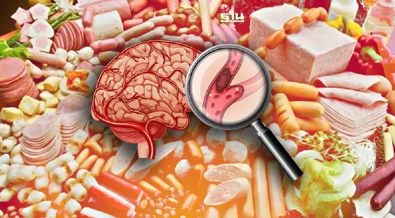 เตือน!กิน"อาหารแปรรูปสูง"เสี่ยงตายด้วย"โรคหัวใจ-หลอดเลือด"