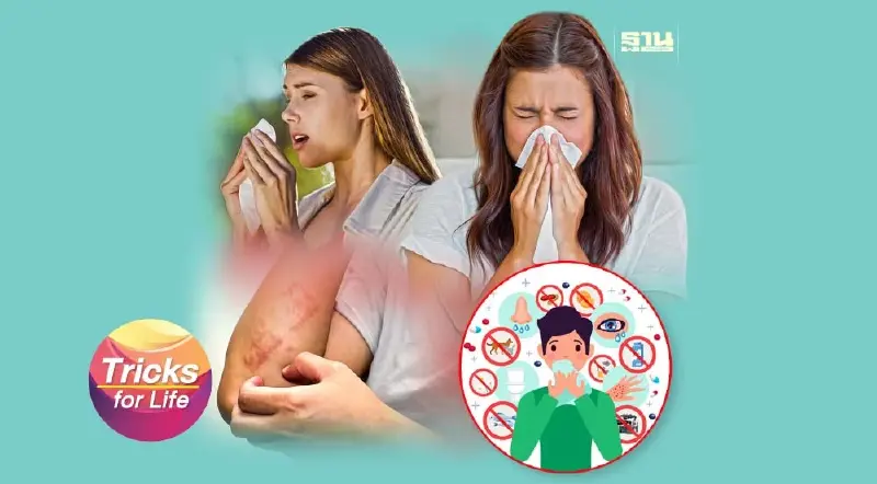 ‘ภูมิแพ้’ โรคยอดฮิตของคนไทย