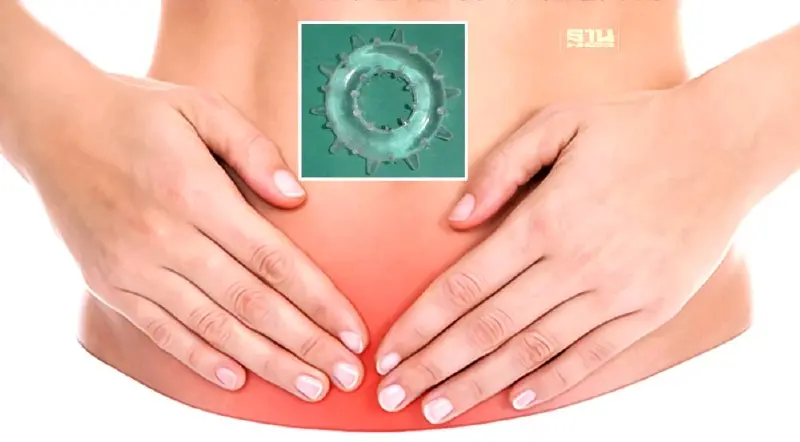 “ขอบตาแพะ” อันตรายถึงขั้น ติดเชื้อในกระแสเลือด ความเชื่อผิดๆที่ไม่เคยหาย