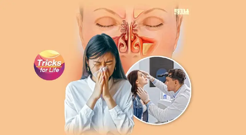 ‘ไซนัสอักเสบ’ ร้ายกว่าที่คิด!
