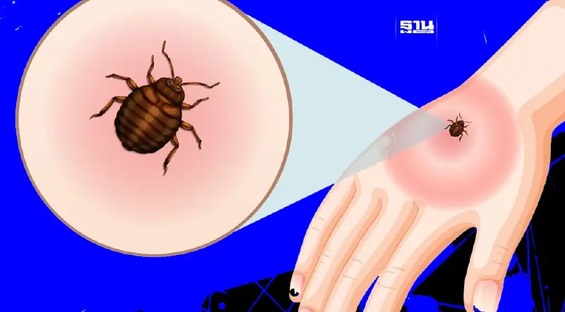 SFTS "โรคเห็บ" แพร่จากคนสู่คน เช็คอาการ ปัจจัยเสี่ยงของโรค 