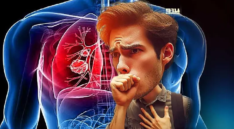 บุหรี่ - PM 2.5  ต้นเหตุ “มะเร็งปอด” ทำคนไทยเสียชีวิต 40 คน/วัน