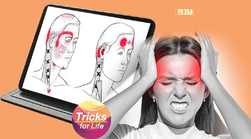 ปวดหัวแบบไหน เรียก‘ไมเกรน’