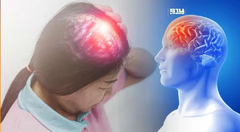 โรคหลอดเลือดสมอง "รู้ เร็ว รอด ปลอดอัมพาต"