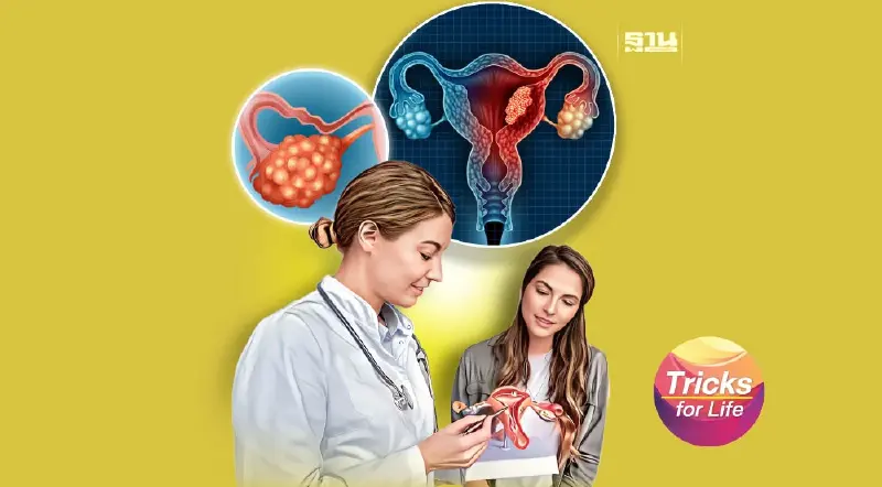 ‘มะเร็งทางนรีเวช’ ภัยเงียบ ของผู้หญิง