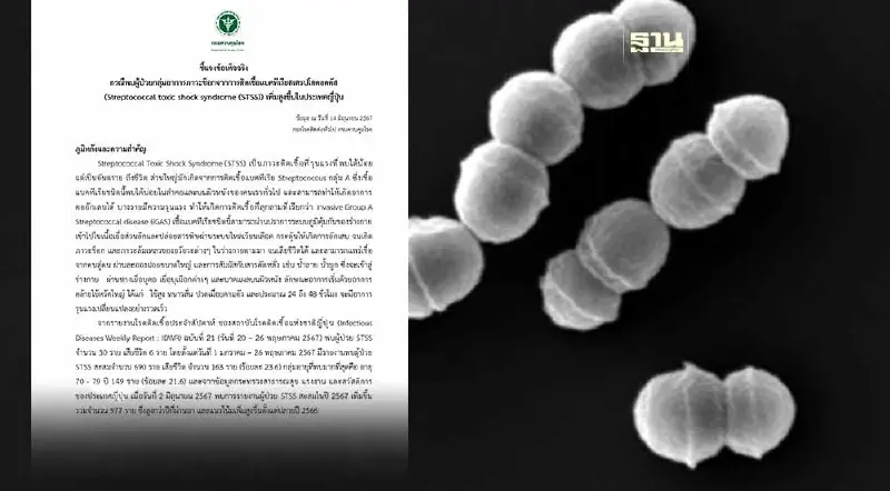 สธ. แจงข้อเท็จจริงปมพบผู้ป่วยช็อกจากเชื้อ STSS เพิ่มขึ้นในญี่ปุ่น 