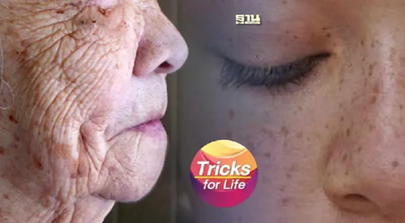 วิธีรักษา "กระแดด" ในผู้สูงอายุ วิธีรักษา "กระแดด" ในผู้สูงอายุ