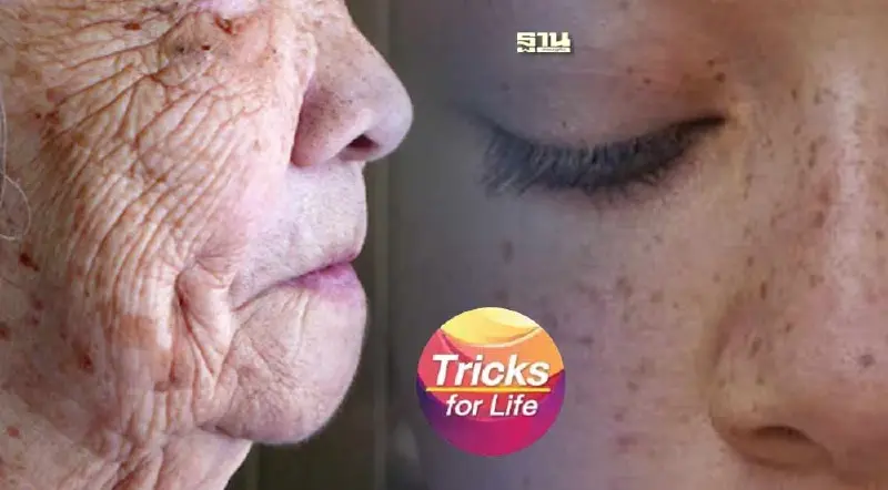 วิธีรักษา "กระแดด" ในผู้สูงอายุ