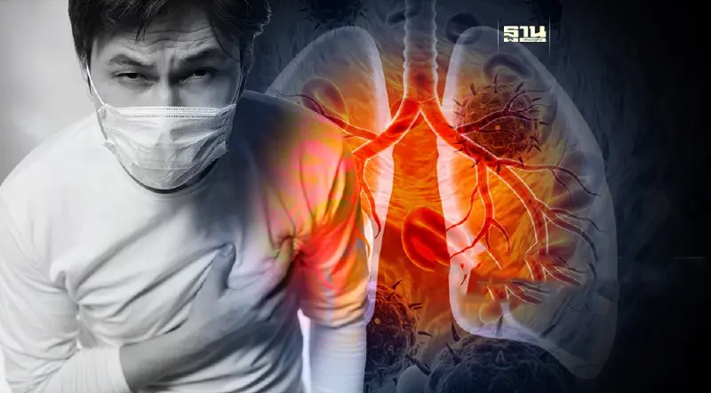 คนไทยป่วยมะเร็งปอด 64 คนต่อวัน เสี่ยงเสียชีวิตภายใน 5 ปี