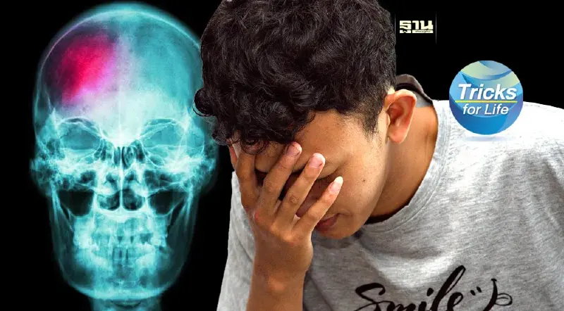 ปวดหัวรุนแรง พูดไม่ชัด คล้ายคนเมา เสี่ยง “เลือดออกในสมอง” อันตรายถึงชีวิต