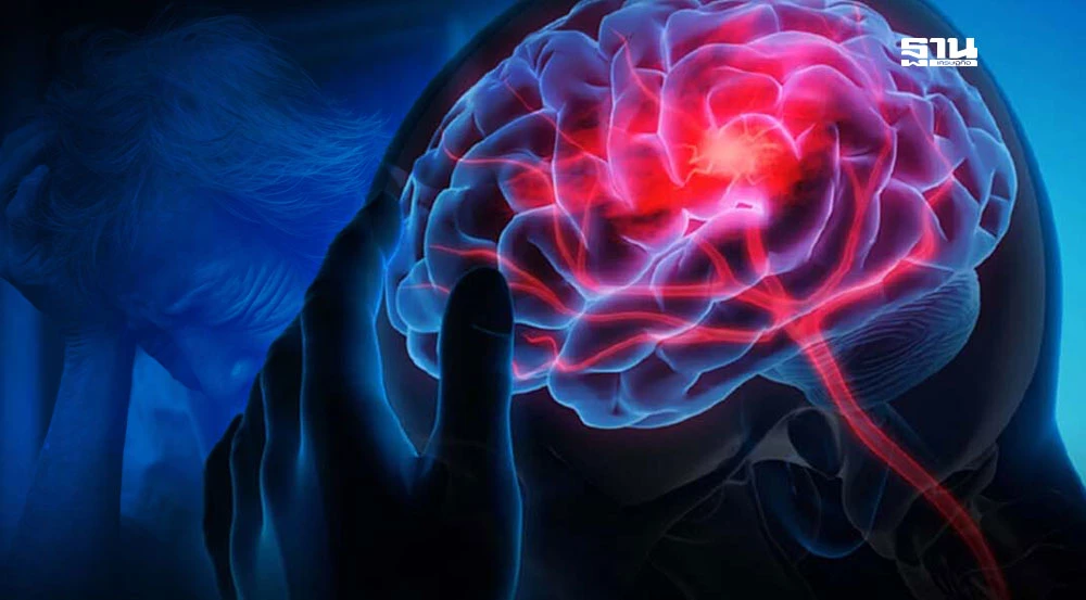 Understanding Aphasia: A Information to Language Impairments and Their Causes