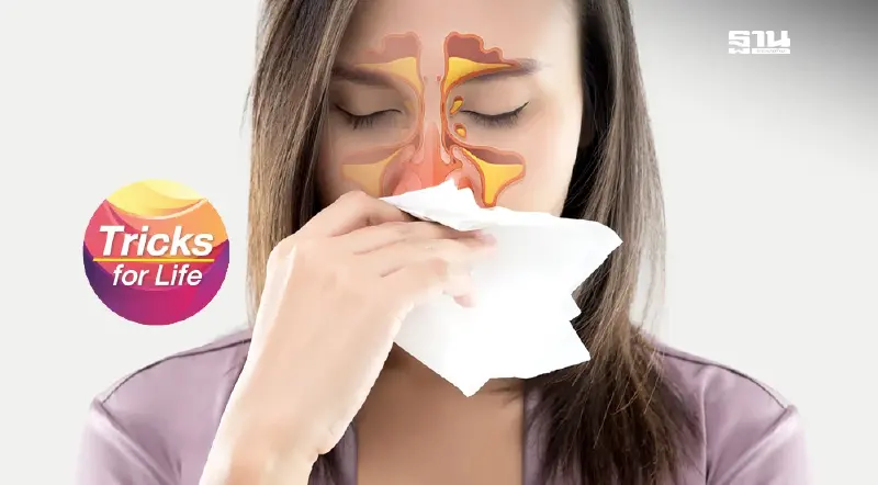 “ไซนัสอักเสบ” อย่าปล่อยไว้